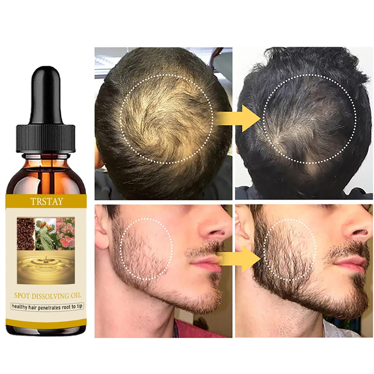 50 ml Bartwachstumsöl, Anti-Al – Beard Oil Bewertung und Preis